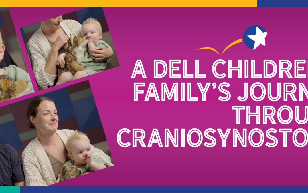 A Dell Children’s Family’s Journey Through Craniosynostosis