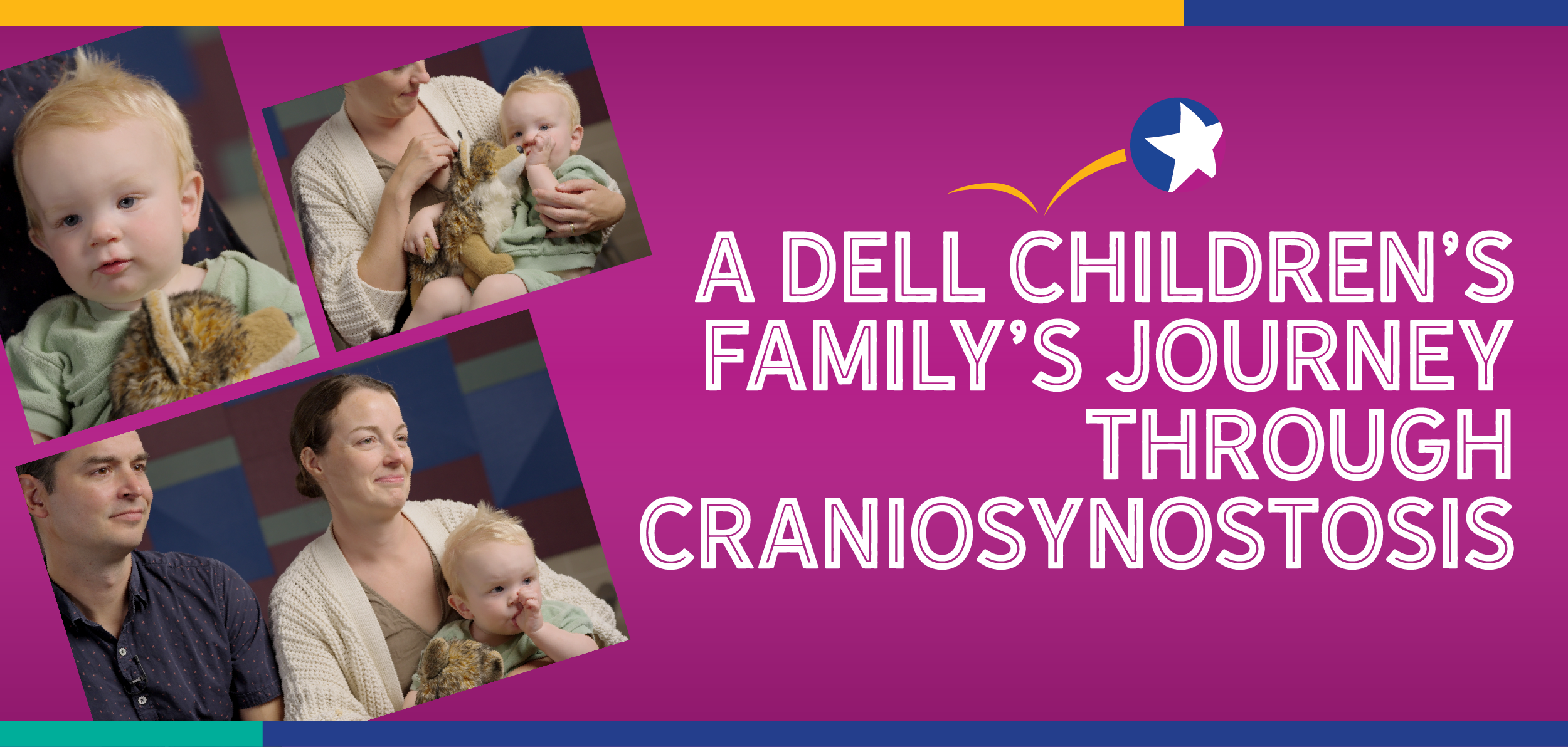 A Dell Children’s Family’s Journey Through Craniosynostosis